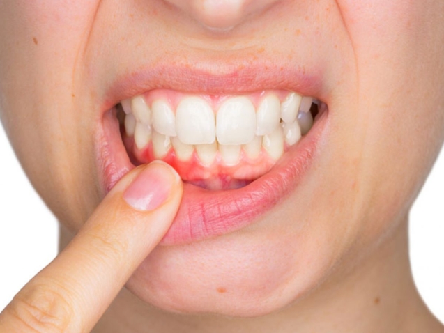 enfermedad-periodontal-1200x900